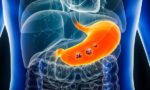 66bb5f30fa7afbc3ac09c763_Gastric-cancer