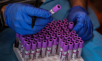 673ef7f6a9837b04c9083d80_blood-testing-india-getty