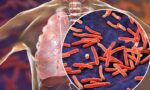 67fe3d4f036b5127e3771ad9_How-PoCT-AI-guided-lung-ultrasound-boosts-TB-diagnosis