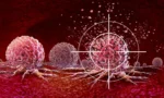 688722324336ef8453156f97_targeting-cancer-cells-ultrasound