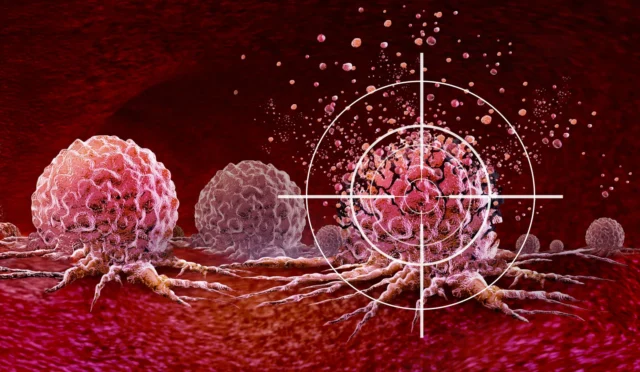 688722324336ef8453156f97_targeting-cancer-cells-ultrasound