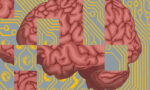 68a6c70fa0b9c9114beec822_AlzheimersBrainFeatureCopy