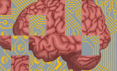 68a6c70fa0b9c9114beec822_AlzheimersBrainFeatureCopy