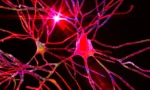 68d64b2ccc5b8f644eea457e_huntingtons-disease-gene-therapy