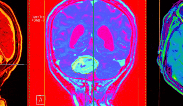 68db8ec3bbb5f369b46f13c5_bc_850_430