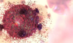 cancer cure treatment T-cell lymphocyte killing tumors
