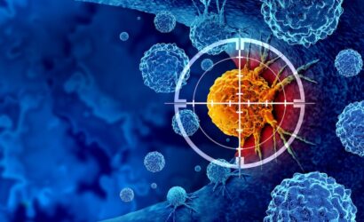 Cancer Detection