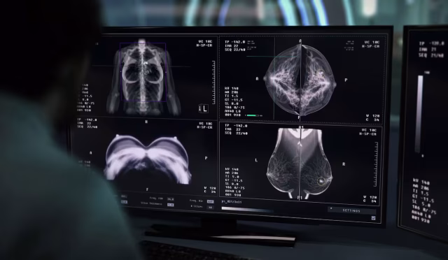 2EFMXGF3PJERHPVUNL5DHKDN2I