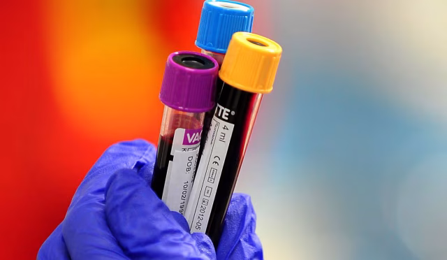 0_Prostate-specific-antigen-testing