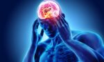 How-to-Know-If-Your-Headache-Is-a-Migraine-1080x675
