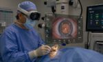 Vision-Pro-in-cataracts-surgery-1020x574