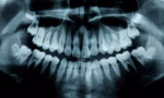 childs-dental-x-rays-royalty-free-image-1691692055