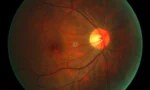 optic-nerve-right-eye--1280x853