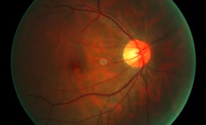 optic-nerve-right-eye--1280x853